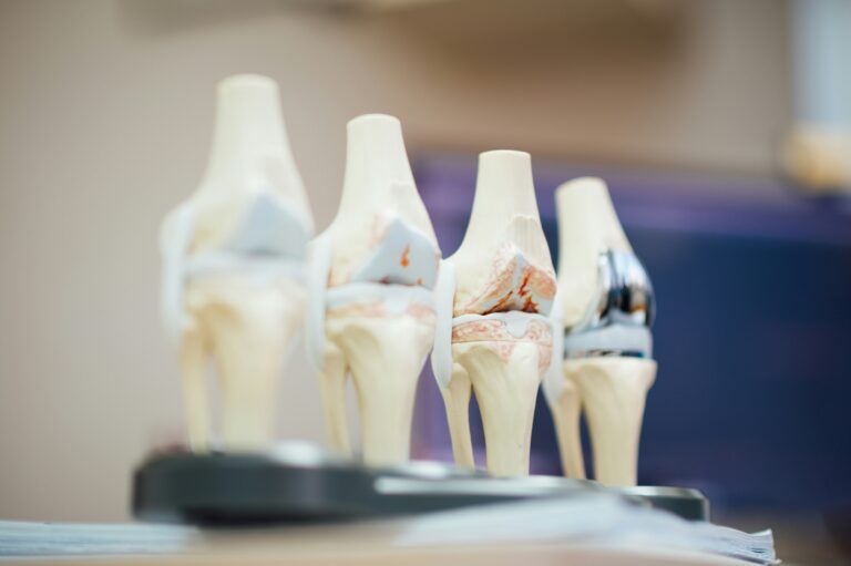 Bone Density After Menopause: What the Research Says About Supplements (It Is More Specific Than Most Advice)